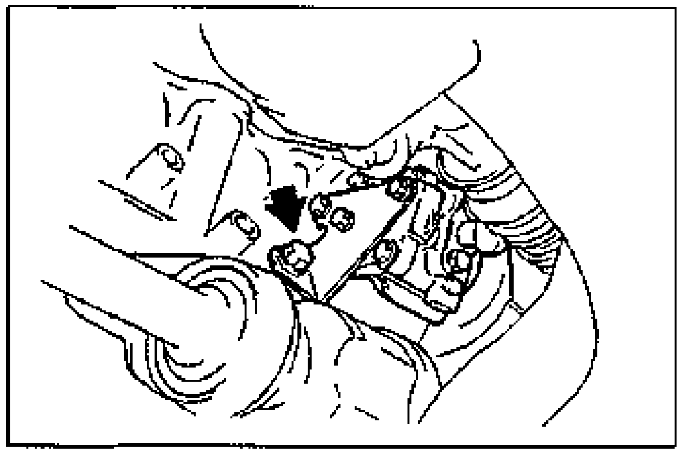 Line drawing of the P/S oil pump bracket with an arrow pointing to a bolt to be removed.