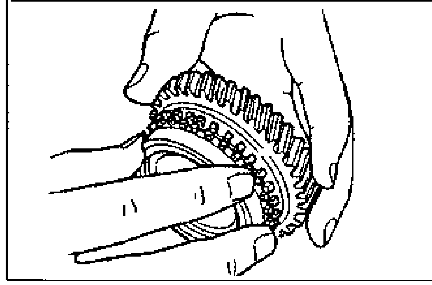 Line drawing of hands inspecting the synchronizer ring teeth and tapered surface for damage, wear and cracks.
