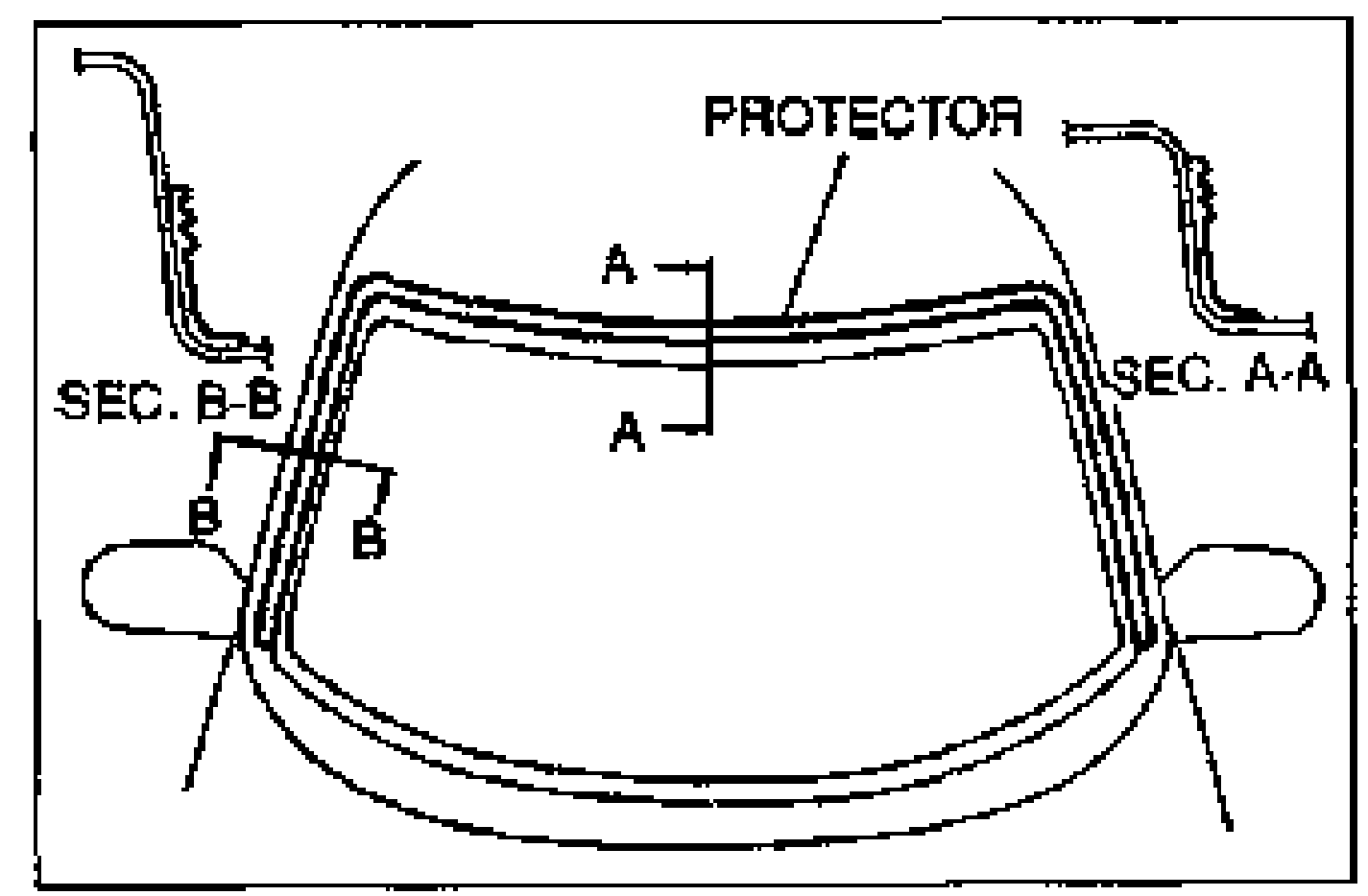 Cross-section of the repair sealant bead application on glass with dam. Dimensions: 11 (0.43) bead height, 5 (0.2) widths. A hand with a sealant gun and a magnified inset of the nozzle tip are shown. Labeled SEALANT, DAM, GLASS; unit note 'mm (in)'.